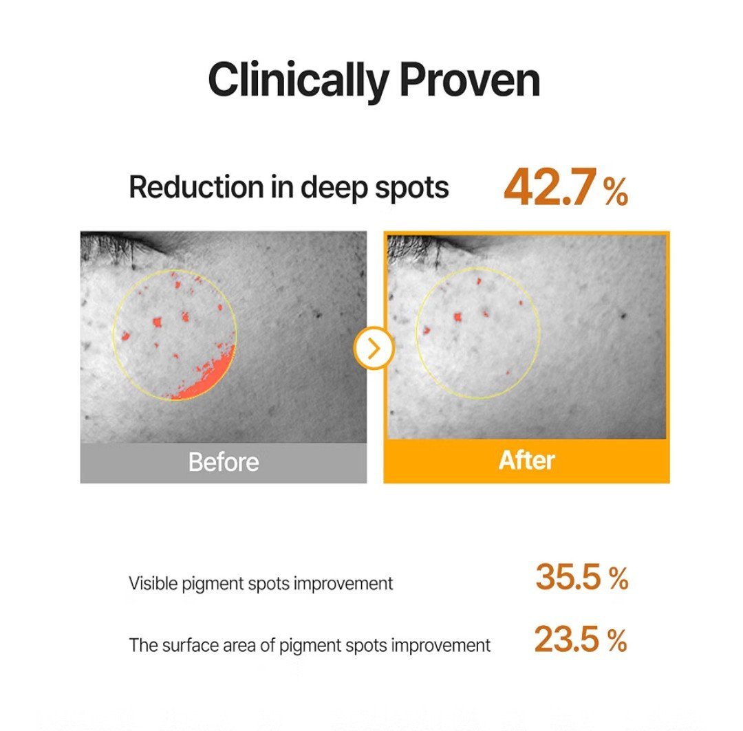 Sérum: Pore+ dark spot brightning